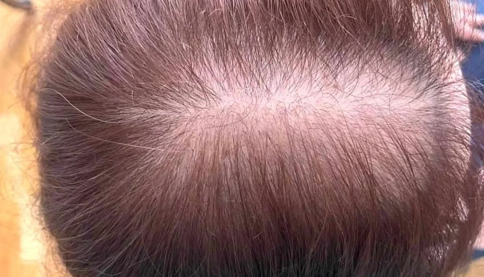 101 Hair Clinic -  веб страница - Скопје