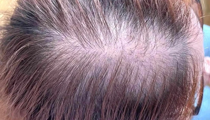 101 Hair Clinic -  промоција - Скопје