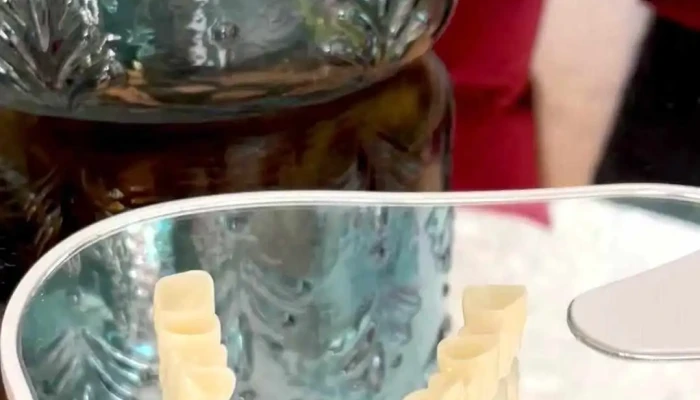 Aesthetic Dental World By Dr Angela Murdzeva Od Sopstvenikot - Гевгелија