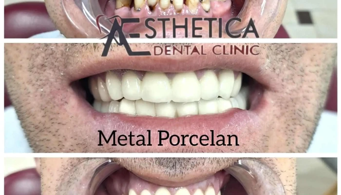 Aesthetica Dental Clinic Od Sopstvenikot - Rruga E Lubotenit 117, Tetovo 1201