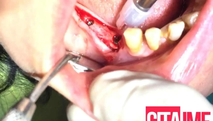 Biodent 1   Stomatoloshka Ordinatsija Zab - Кичево