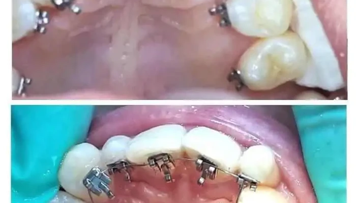Denta Lux Skopje -  Zab - Скопје