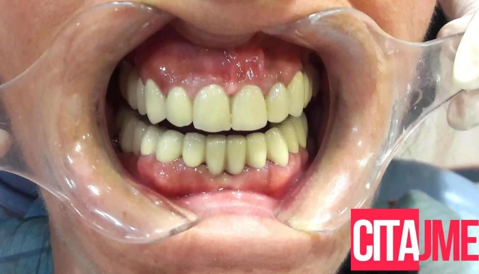 Dental Care Dr Lukanoski Sie - Скопје