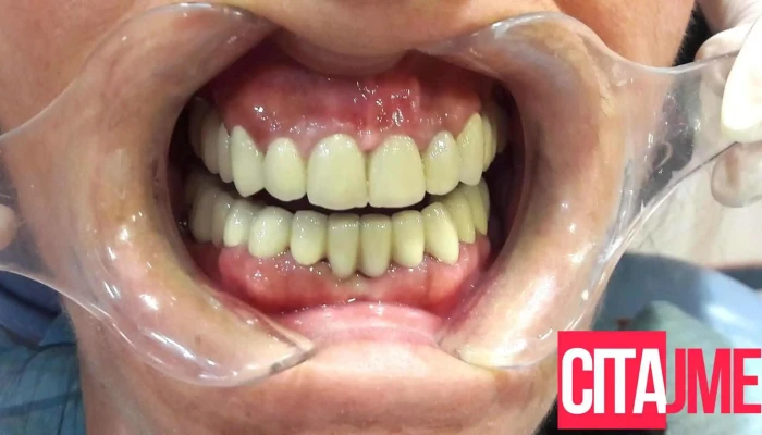 Dental Care Dr. Lukanoski - Скопје