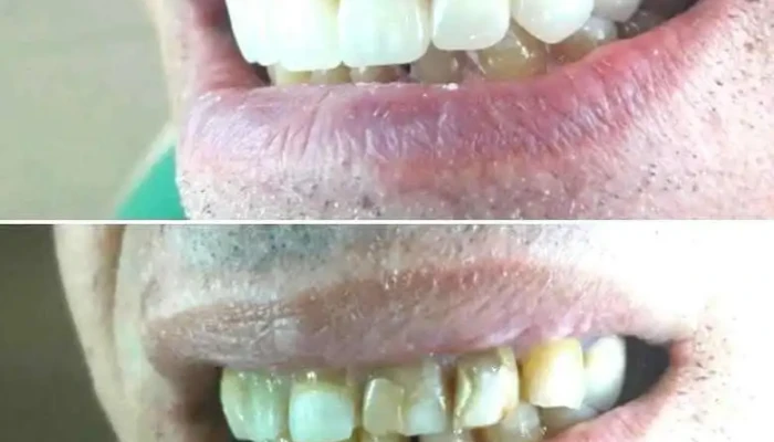 Dental Centar Pop -  Ristovi Zab - Zelecnicka