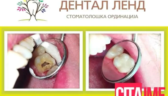Dental Land -  Zab - Куманово