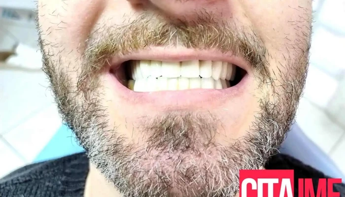 Dental Studio Ars Od Sopstvenikot - Скопје