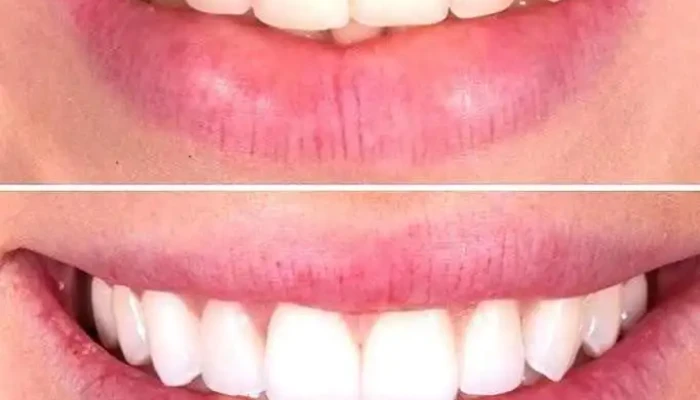 Dental Studio Dr. Irena Hristov - Струмица