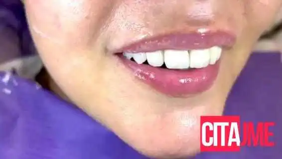 Dentalni Estetski Solutsii   Dr Kristina Videa - Скопје