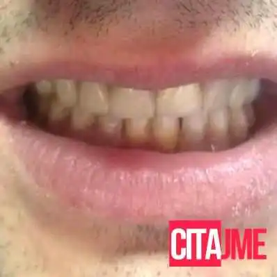 Dentalux Kumanovo -  Zab - Куманово