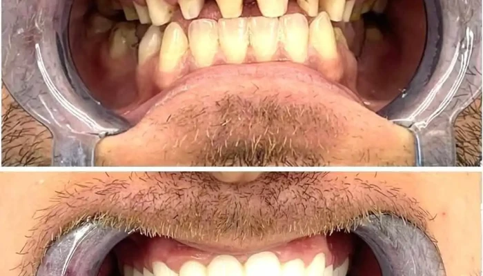 Dentalux Tetove 1 Od Sopstvenikot - Тетово