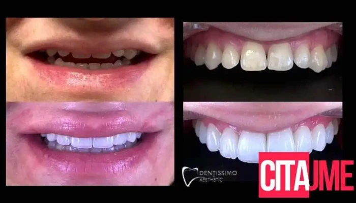 Dentissimo Aesthetic Dr Sanja Dimova Videa - Скопје