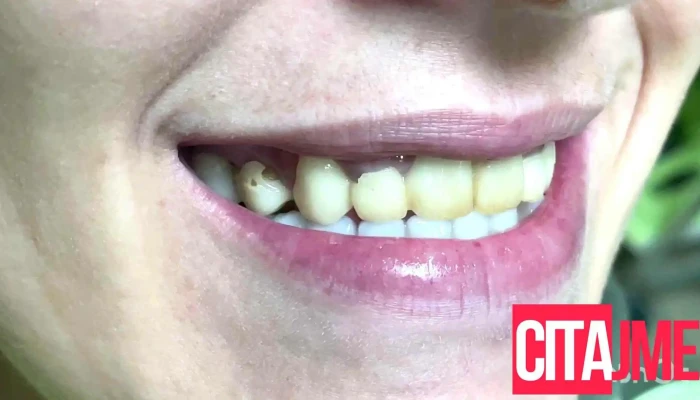 Dentist Protetika Petkovi -  Od Sopstvenikot - Скопје