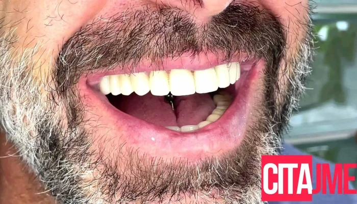 Dentist Protetika Petkovi -  Videa - Скопје