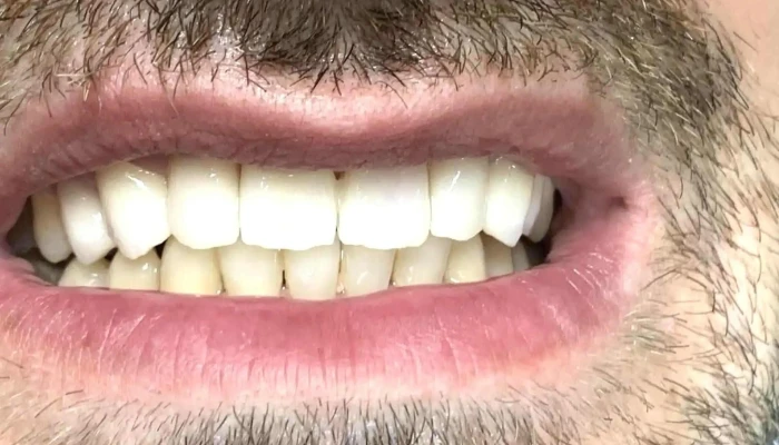 Dentist Protetika Petkovi -  попусти - Скопје