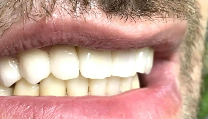 Dentist Protetika Petkovi - Скопје