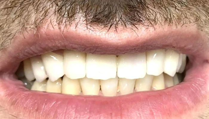 Dentist Protetika Petkovi -  фотографии - Скопје