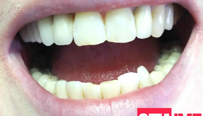 Dentizar Od Sopstvenikot - Скопје