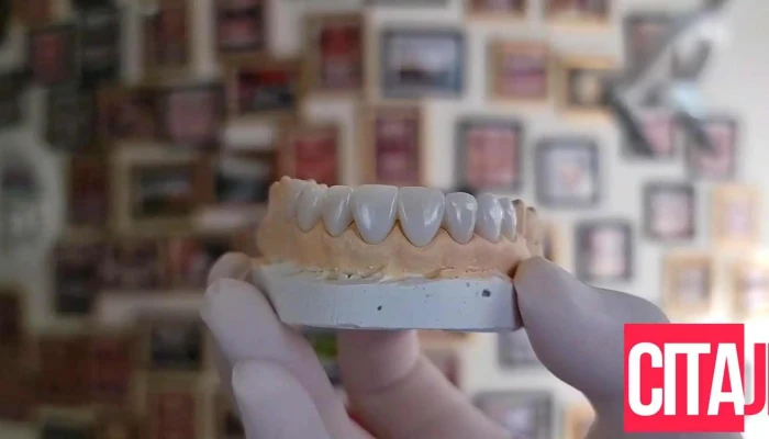 Drsemi Dental Clinic Od Sopstvenikot - Гостивар