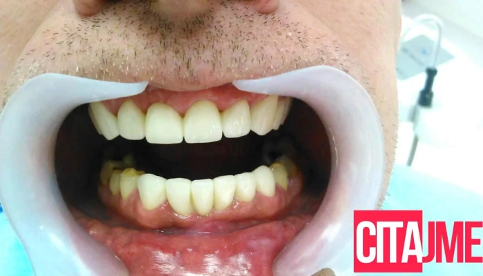 Interplus Dental Clinic -  Zab - Скопје