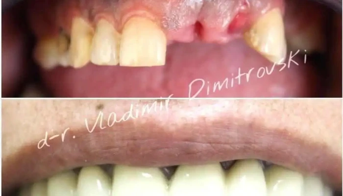 Jove Dent Dental Center -  Od Sopstvenikot - Битола