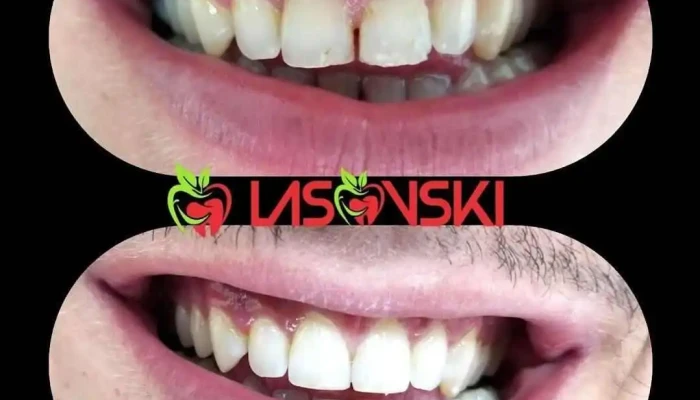 Lasovski Dental Office - Охрид