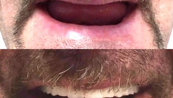 Mediana Dental -  Zab - Скопје