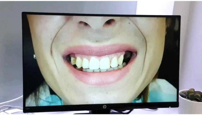 Prodent -    Dental Clinic Od Sopstvenikot - Тетово