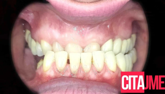 Rendevski Dental Clinic -  Od Sopstvenikot - Битола