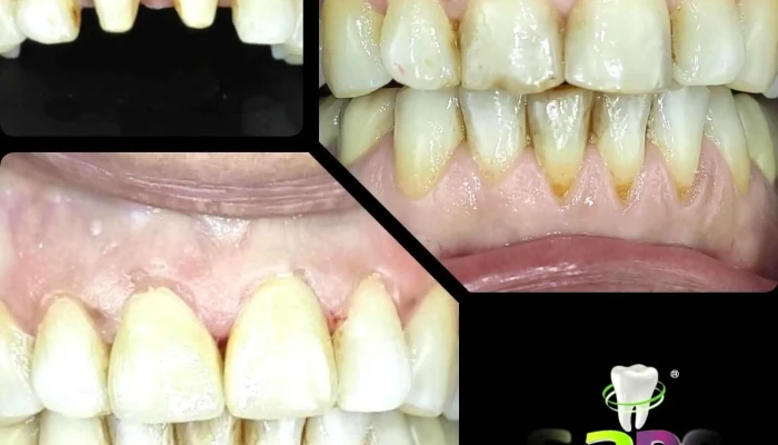 Rendevski Dental Clinic -  Zab - Битола