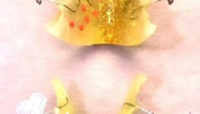 Stomataloshka Ordinatsija Denta Luks Videa - Радовиш