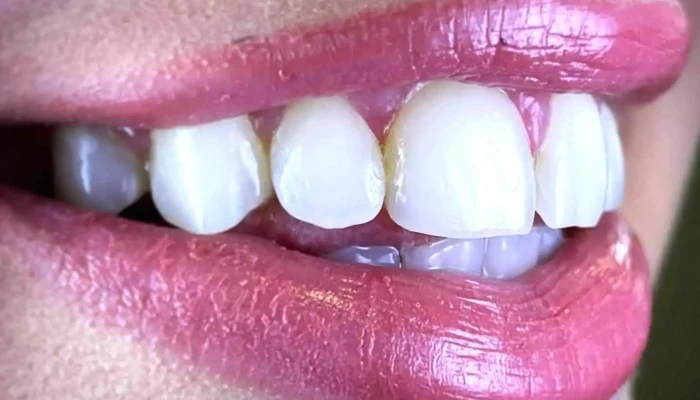 Stomataloshka Ordinatsija Denta Luks Zab - Радовиш