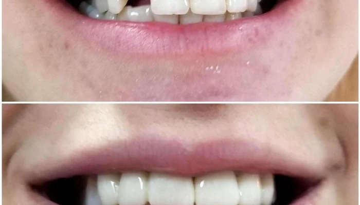 Stomatoloska Ordinacija Dentallica Novo Lisice -  стоматолошка клиника - Скопје
