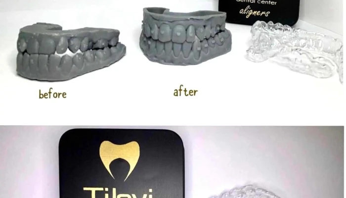 Tilevi Dental - Охрид