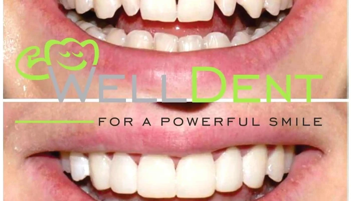 Welldent Bitola Veldent Zab - Битола