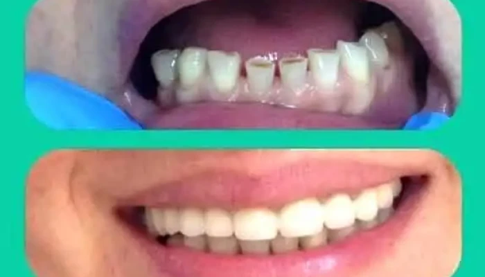 Zlatanoski Dental Od Sopstvenikot - Охрид
