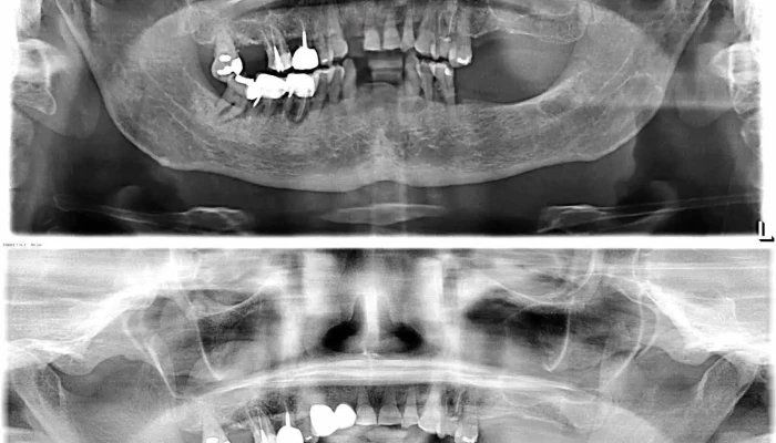 Zlatanoski Dental Rendgenski Zratsi - Охрид