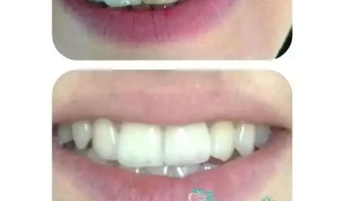 Zlatanoski Dental Sie - Охрид