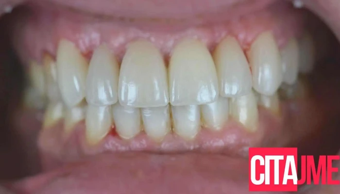 Д-р. Караџоски | Dentist Karadzoski - Прилеп